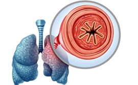 Copd Doctor in Gurgaon